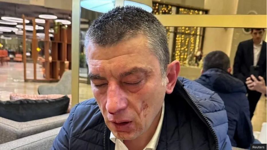Georgian opposition leader beaten up, blames governing party members